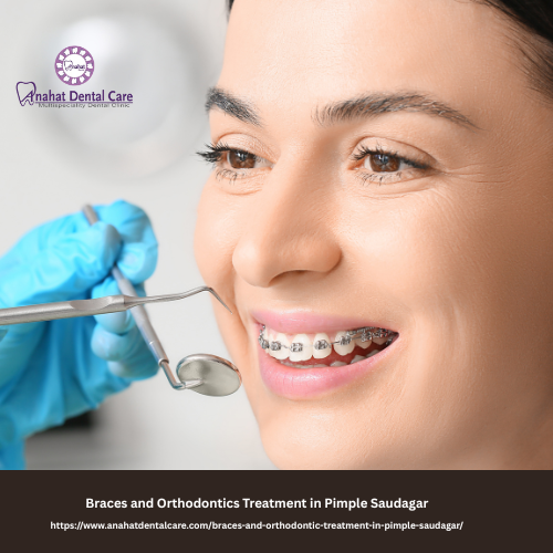 Braces and Orthodontics Treatment in Pimple Saudagar