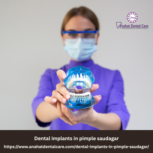 Dental implants in pimple saudagar